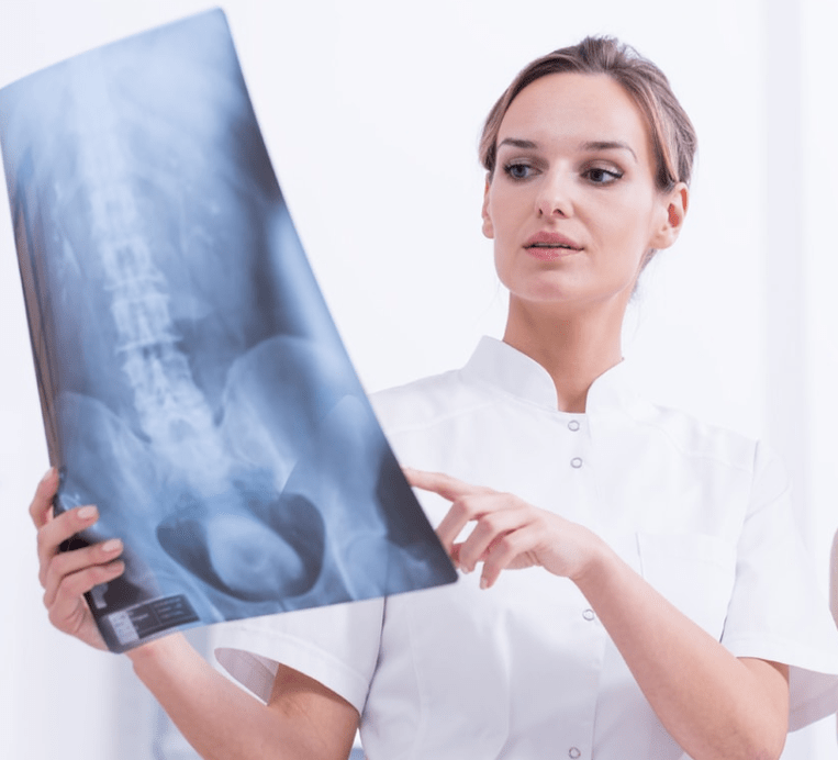 Krūtinės ląstos osteochondrozės diagnozė rentgeno tyrimu