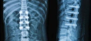 x-ray-nugaros